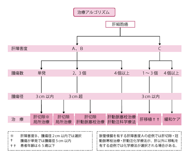 治療アルゴリズム 肝細胞癌の肝障害度がA、B、腫瘍数が単発、腫瘍径が3㎝以内の場合は、肝切除と局所治療を行います。肝切除は、肝障害度B、腫瘍径2cm以内では選択します。肝細胞癌の肝障害度がA、B、腫瘍数が2、3個、腫瘍径が3㎝超の場合は、肝切除と局所治療、または、肝切除と肝動脈塞栓治療を行います。肝細胞癌の肝障害度がA、B、腫瘍数が4個以上の場合は、肝動脈塞栓治療と肝動注科学療法を行います。肝細胞癌の肝障害度がC、腫瘍数が1～3個、腫瘍径が3㎝以内の場合は、肝移植を行います。この治療の患者年齢は65歳以下が対象です。肝細胞癌の肝障害度がC、腫瘍数が4個以上の場合は、緩和ケアを行います。脈管侵襲を有する肝障害度Aの症例では肝切除・肝動脈塞栓治療・肝動注科学療法が、肝以外に移転を有する症例では化学療法が選択される場合があります。