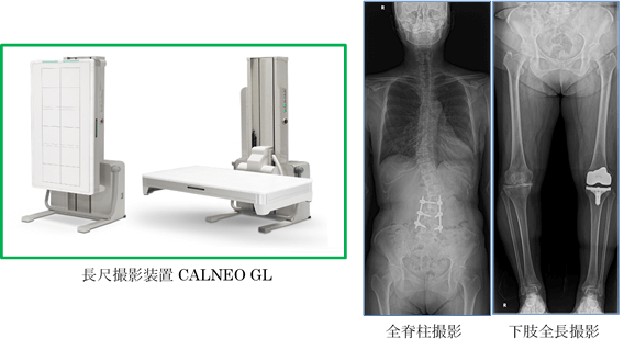 長尺撮影装置 CALNEO GL / 全脊柱撮影 下肢全長撮影