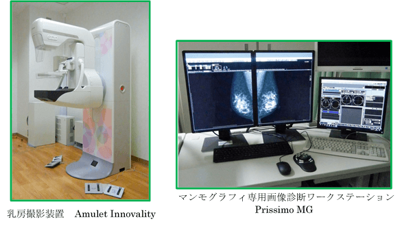 乳房撮影装置 Amulet Innovality / マンモグラフィ専用画像診断ワークステーション Prissimo MG